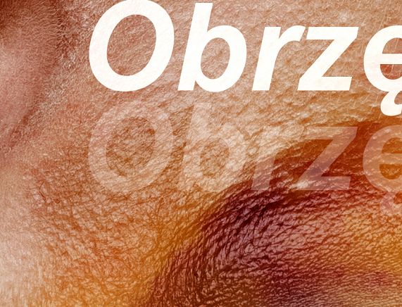 Marta Zgierska wystawa "Obrzęk"